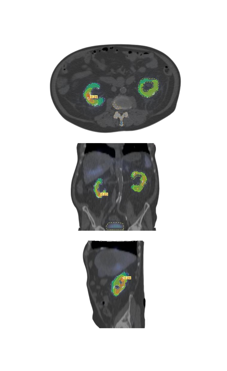 Dosimetry Images