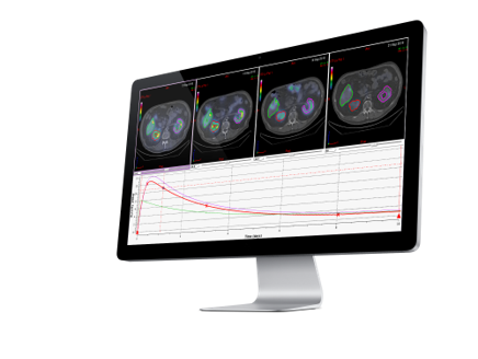 PLANET® Dose dosimetry software interface showing voxel dose map